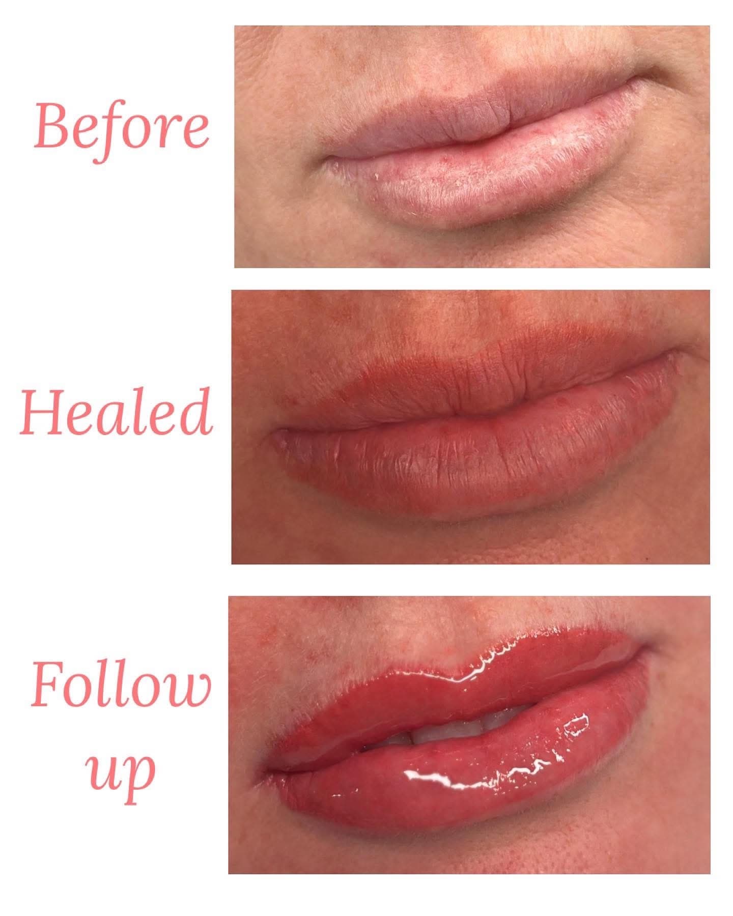Lip tattoo photo collage labelled Before, Healed and Follow up